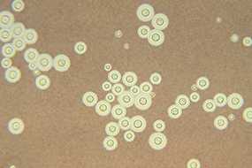 	A photomicrograph of Cryptococcus neoformans using a light India ink staining preparation.