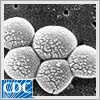 Staphylococcus aureus resistente a la meticilina (SARM)