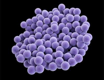 Medical illustration of methicillin-resistant Staphylococcus aureus (MRSA)
