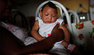 A baby born with microcephaly in Brazil (Source: Mario Tama/Getty)