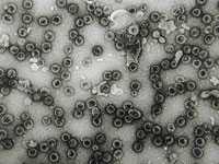 Electron Microscopy of human papillomavirus
