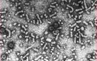 Electron Microscopy of the Hepatitis B Virus