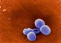 Electron Microscopy of Streptococcus pneumoniae