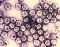Electron microscopy of Rotavirus