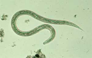 Filariform (L3) hookworm larva in a wet mount.
