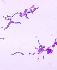 A photomicrograph of Streptococcus spp. bacteria using Gram stain technique. Six groups are in this genus: A, B, C, D, F, and G, which and are often found in pairs or chains. This organism causes respiratory infections such as pneumonia and sinusitis, as well as bacteremia, otitis media, meningitis, peritonitis and arthritis.