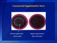 Commercial Agglutination Tests.