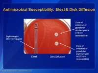 Antimicrobial Susceptibility: Etest & Disk Diffusion.
