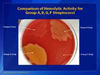Comparison of Hemolytic Activity for Group A, B, G, F Streptococci.