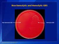 Non-hemolytic and Hemolytic GBS