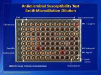 Antimicrobial Susceptibility Test Broth Microdilution Dilution.