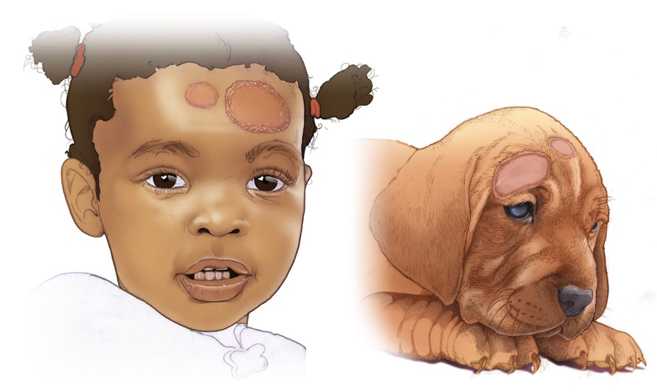 illustration of girl and dog, both with red patches on their skin