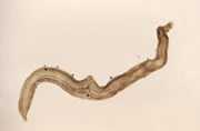 	Microscopic Schistosoma mansoni. CDC/Shirley Maddison