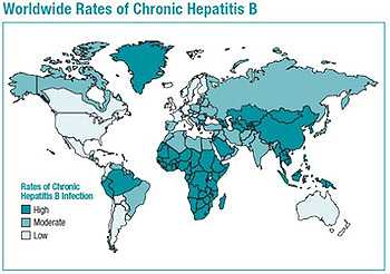 World map showing high, moderate, and low rates of Chronic Hepatitis B