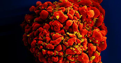 Image of HIV virus