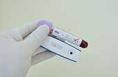 NHBS HIV Test