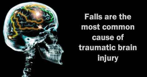 Falls are the most common cause of traumatic brain injury