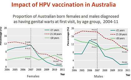 Impact of HPV vaccination in Australia.