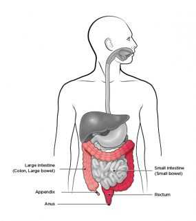 Image shows the human digestive system with areas affected by Ulcerative Colitis highlighted