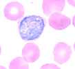 Plasmodium vivax gametocyte