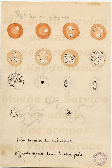Illustration drawn by Laveran of various stages of malaria parasites as seen on fresh blood