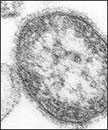 Microfotografía electrónica de barrido (TEM) de un corte ultrafino que revela los detalles ultraestructurales de una sola partícula, o “virión”, , del virus del sarampión. El virus del sarampión es un paramixovirus, del género Morbillivirus.