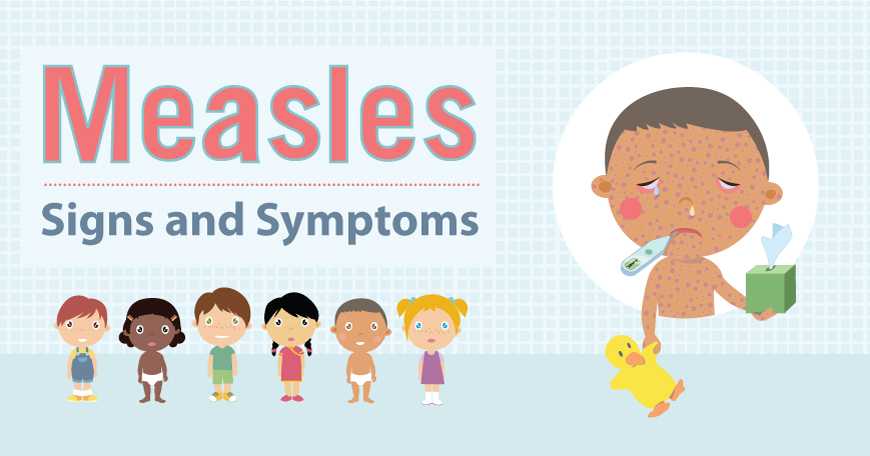 Measles Signs and Symptoms