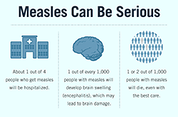 Infographic. Measles can be serious.