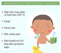 Infographic. Measles symptoms typically include