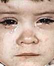 Niño pequeño con enfermedad moderada: moqueo, ojos llorosos causados por la infección por sarampión