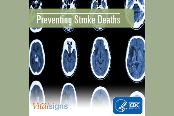 Preventing stroke deaths - background shows brain scan images