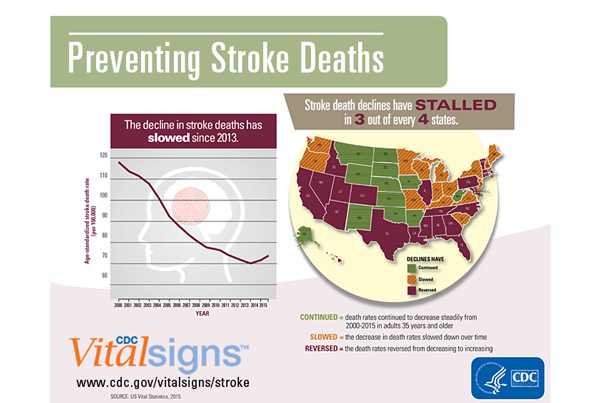 Infographic: The decline in stroke deaths has slowed since 2013. Stroke deaths have stalled in 3 out of every 4 states.