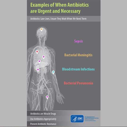 Examples of when antibiotics are urgent and necessary - infographic