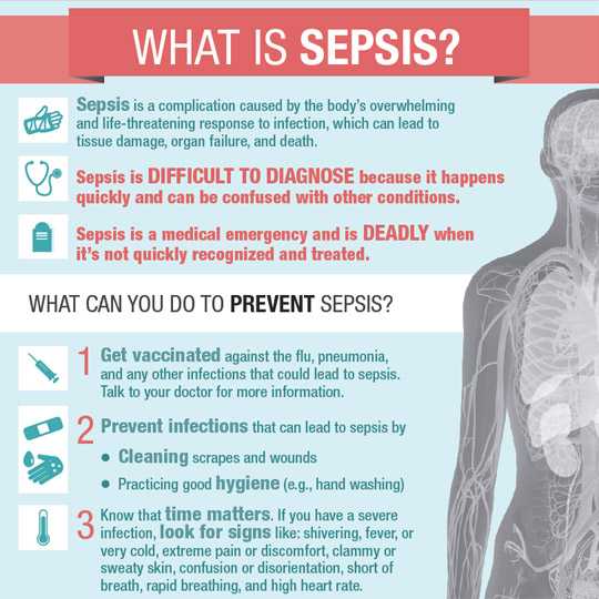infographic what is sepsis