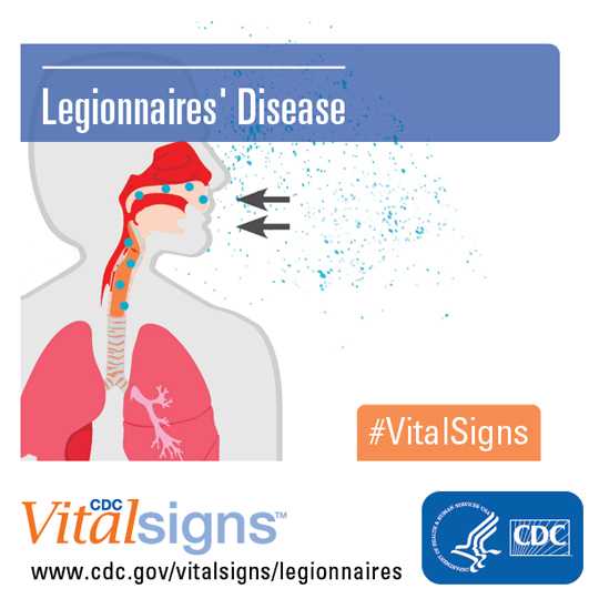 People can get Legionnaires’ disease, a type of serious lung infection (pneumonia), by breathing in small droplets of water that contain Legionella.