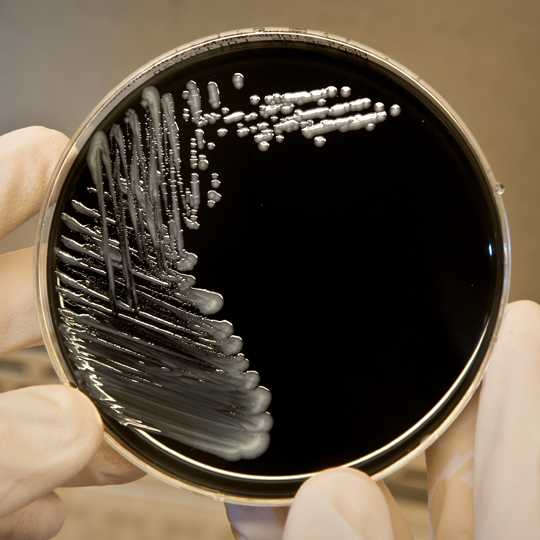 Legionella pneumophila, a bacterium that can cause Legionnaires’ disease, growing on specialized microbiological media (BCYE).