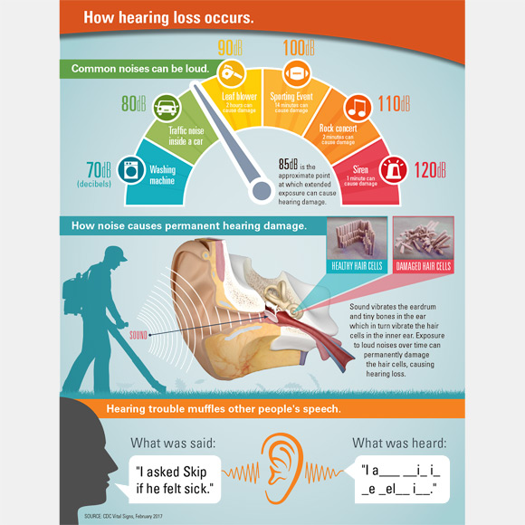 Infographic: How hearing loss occurs.