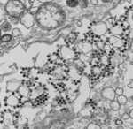 Microscope image of the Heartland Virus