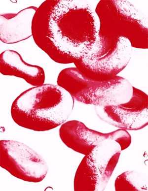 What Causes Hemophilia?