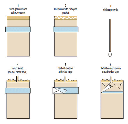 Figure 1 is an image showing the procedure for inoculating silica gel packages for short-term storage.