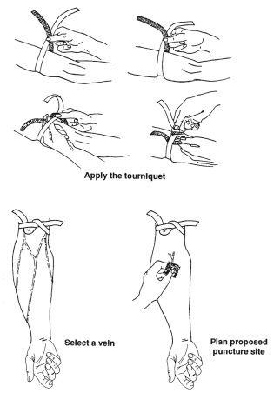 Figure 5 describes how to collect blood from an arm by applying a tourniquet, selecting a vein, and preparing the proposed puncture site.