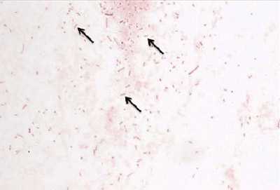 Figure 3 is a picture of a gram stain of H. influenzae.