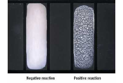 Figure 4 depicts negative and positive latex agglutination reactions.