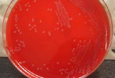 Figure 6 is a picture showing proper streaking and growth of N. meningitidis on a blood agar plate (BAP).