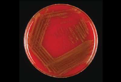 Figure 7 is a picture showing proper streaking and growth of S. pneumoniae on a blood agar plate (BAP).