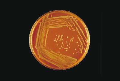 Figure 8 is a picture showing proper streaking and growth of H. influenzae on a blood agar plate (BAP).