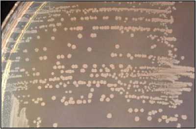 Figure 9 is a picture showing growth of Salmonella ser. Typhi on MacConkey agar.
