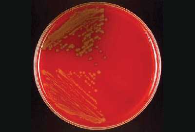 Figure 10 is a picture showing growth of N. meningitidis on lower left and S. pneumoniae on upper left of a blood agar plate (BAP).