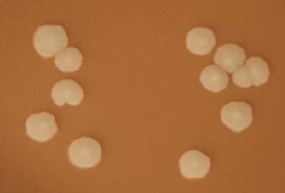 Figure 12 is a picture showing H. influenzae colonies on a chocolate agar plate (CAP).