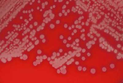 Figure 13 is a picture showing N. meningitidis colonies on blood agar plate (BAP).